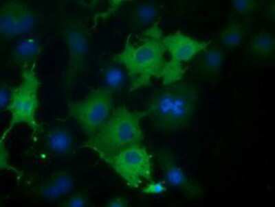 Immunocytochemistry/ Immunofluorescence: CORO1B Antibody (OTI3D10) [NBP2-02902]