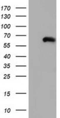 Western Blot: CORO1B Antibody (OTI3D10) [NBP2-02902]
