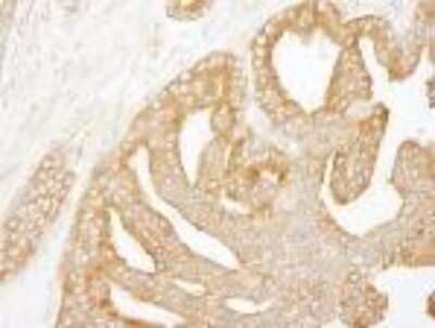 Immunohistochemistry-Paraffin: CORO1B Antibody [NB100-61040]