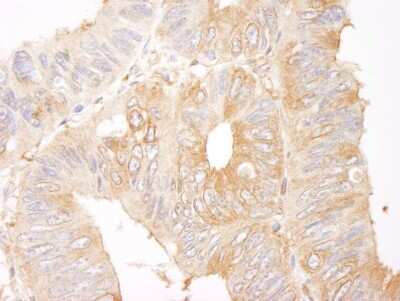 Immunohistochemistry-Paraffin: CORO1B Antibody [NB100-61040]