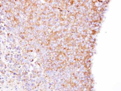 Immunohistochemistry-Paraffin: CORO1B Antibody [NBP1-32514]