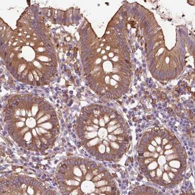 Immunohistochemistry-Paraffin: CORO1B Antibody [NBP2-49634]