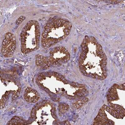 Immunohistochemistry-Paraffin: CORO1B Antibody [NBP2-49634]