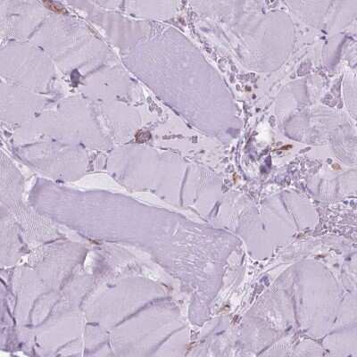 Immunohistochemistry-Paraffin: CORO1B Antibody [NBP2-49634]