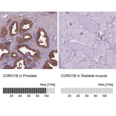 Immunohistochemistry-Paraffin: CORO1B Antibody [NBP2-49634]