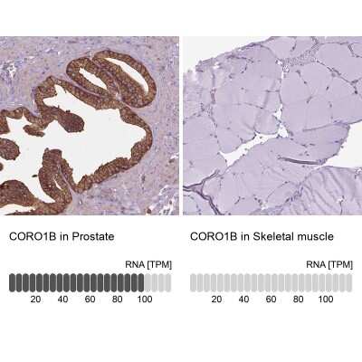 Immunohistochemistry-Paraffin: CORO1B Antibody [NBP2-49634]