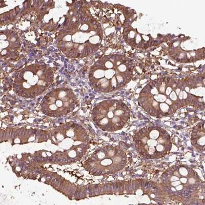 Immunohistochemistry-Paraffin: CORO1B Antibody [NBP2-49634]