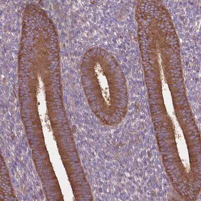 Immunohistochemistry-Paraffin: CORO1B Antibody [NBP2-49634]
