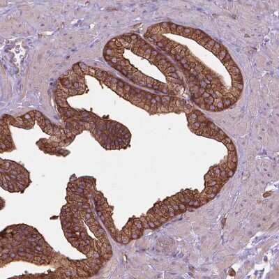 Immunohistochemistry-Paraffin: CORO1B Antibody [NBP2-49634]
