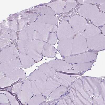 Immunohistochemistry-Paraffin: CORO1B Antibody [NBP2-49634]