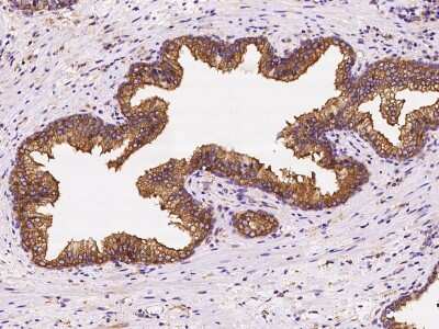 Immunohistochemistry-Paraffin: CORO1B Antibody [NBP2-98597]