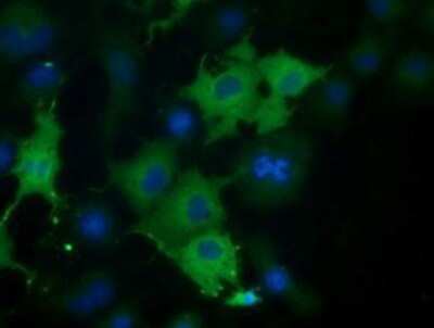 Immunocytochemistry/ Immunofluorescence: CORO1B Antibody (OTI3D10) - Azide and BSA Free [NBP2-72086]