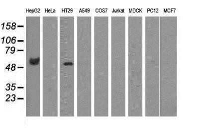 Western Blot: CORO1B Antibody (OTI3D10)Azide and BSA Free [NBP2-72086]