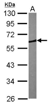 Western Blot: CORO1B Antibody [NBP1-32514]