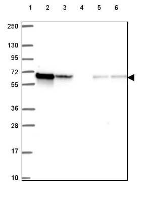 Western Blot: CORO1B Antibody [NBP2-49634]