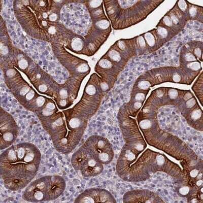 Immunocytochemistry/ Immunofluorescence: CORO2A Antibody [NBP1-81583]