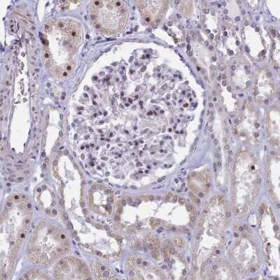 Immunohistochemistry-Paraffin: CORO2A Antibody [NBP1-81583]