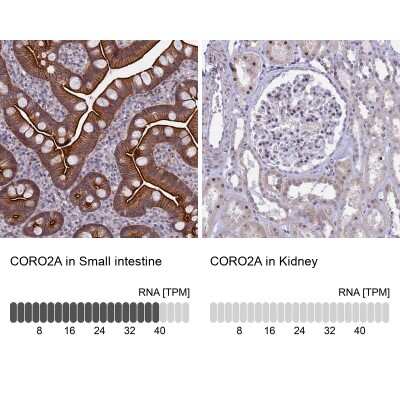 Immunohistochemistry-Paraffin: CORO2A Antibody [NBP1-81583]