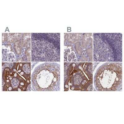 Immunohistochemistry-Paraffin: CORO2A Antibody [NBP1-81583]