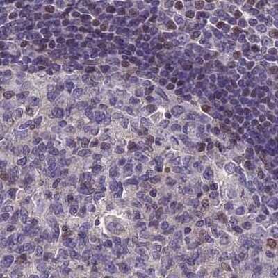 Immunohistochemistry-Paraffin: CORO2A Antibody [NBP1-81583]