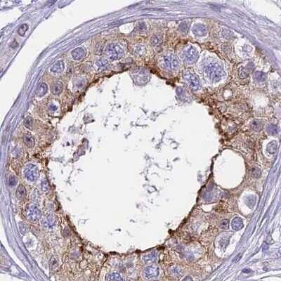 Immunohistochemistry-Paraffin: CORO2A Antibody [NBP1-81583]