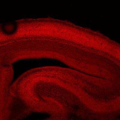 Immunohistochemistry-Frozen: COUP-TF I/NR2F1 Antibody [NBP1-31259]