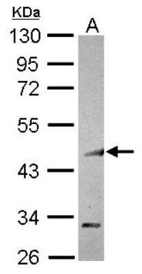 Western Blot: COUP-TF I/NR2F1 Antibody [NBP2-15974]