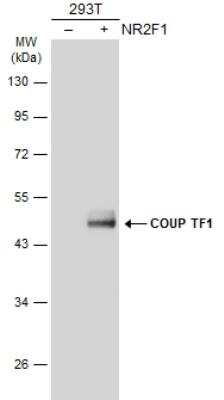 Western Blot: COUP-TF I/NR2F1 Antibody [NBP2-15974]