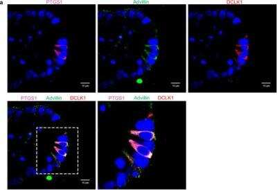 Immunohistochemistry: COX-1 Antibody [NB100-867]