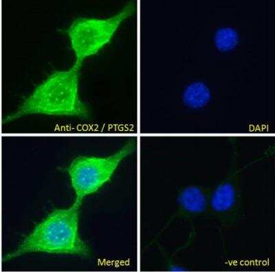 Immunocytochemistry/ Immunofluorescence: COX-2 Antibody [NB100-868]