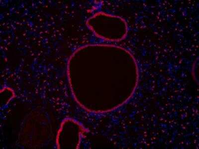 Immunohistochemistry-Paraffin: COX-2 Antibody [NB100-868]