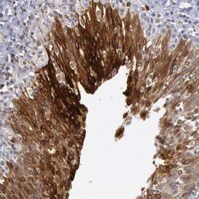 Immunohistochemistry-Paraffin: COX-2 Antibody [NBP1-85499]