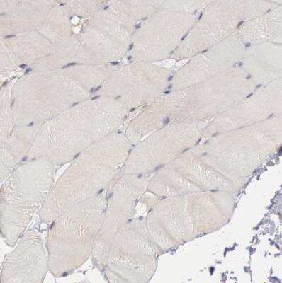 Immunohistochemistry-Paraffin: COX-2 Antibody [NBP1-85499]