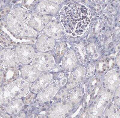 Immunohistochemistry-Paraffin: COX-2 Antibody [NBP1-85499]