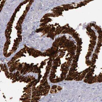 Immunohistochemistry-Paraffin: COX-2 Antibody [NBP1-85499]