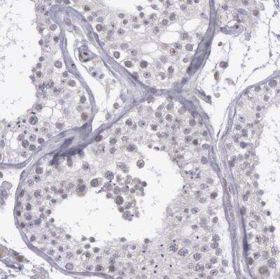 Immunohistochemistry-Paraffin: COX-2 Antibody [NBP1-85499]