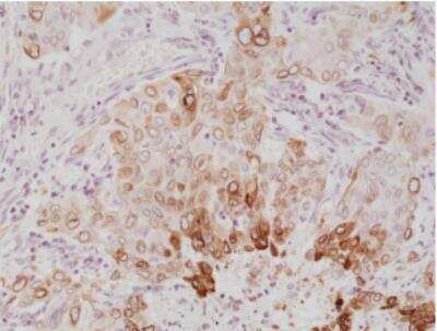 Immunohistochemistry-Paraffin: COX-2 Antibody (RM348) [NBP2-77419]