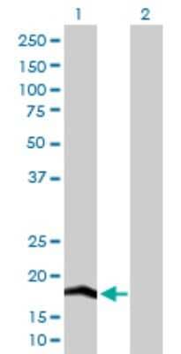 Western Blot: COX IV Isoform 2 Antibody [H00084701-D01P]