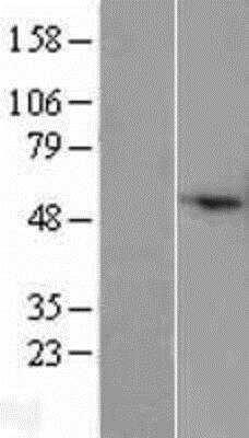 Western Blot: COX IV Isoform 2 Overexpression Lysate [NBP2-05989]