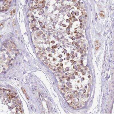 Immunohistochemistry: COX17 Antibody [NBP2-30980]
