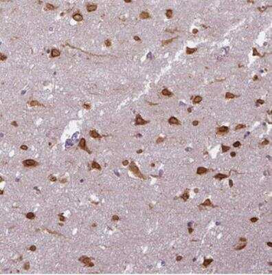 Immunohistochemistry: COX18 Antibody [NBP2-30593]