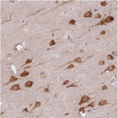 Immunohistochemistry: COX18 Antibody [NBP2-30911]