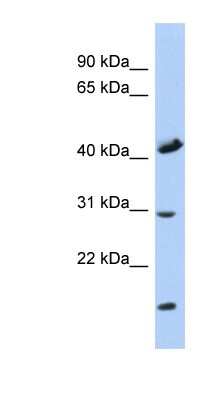 Western Blot: COX18 Antibody [NBP1-59616]