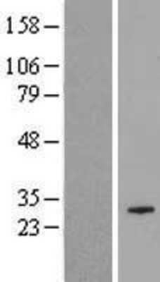 Western Blot: COX18 Overexpression Lysate [NBP2-05105]