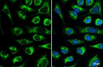 Immunocytochemistry/ Immunofluorescence: COX4 Antibody [NBP2-15975]