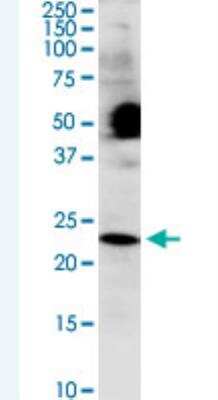 Western Blot: COX4NB Antibody (4F4) [H00010328-M01-100ug]