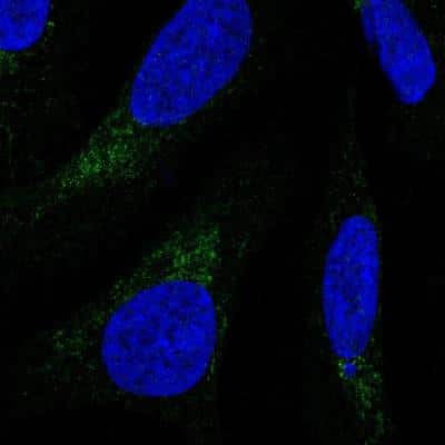 Immunocytochemistry/ Immunofluorescence: COX4NB Antibody [NBP2-13864]