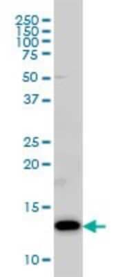 Western Blot: COX5b Antibody (1E8) [H00001329-M03]