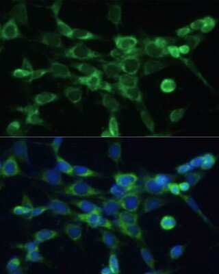 Immunocytochemistry/ Immunofluorescence: COX6A1 Antibody - BSA Free [NBP2-92889]