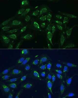 Immunocytochemistry/ Immunofluorescence: COX6A1 Antibody - BSA Free [NBP2-92889]